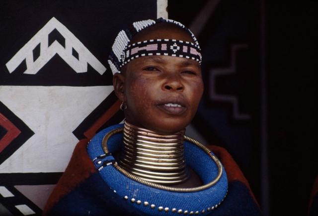 Почему толстая шея вредна для здоровья, и что значит, когда она худая Почему толстая шея вредна для здоровья, и что значит, когда она худая